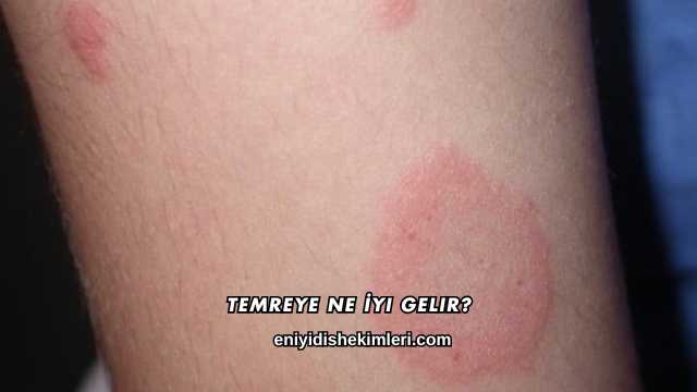 Temreye Ne İyi Gelir?