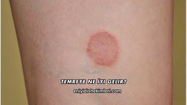 Temreye Ne İyi Gelir?