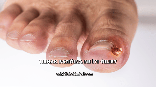 Tırnak Batığına Ne İyi Gelir?
