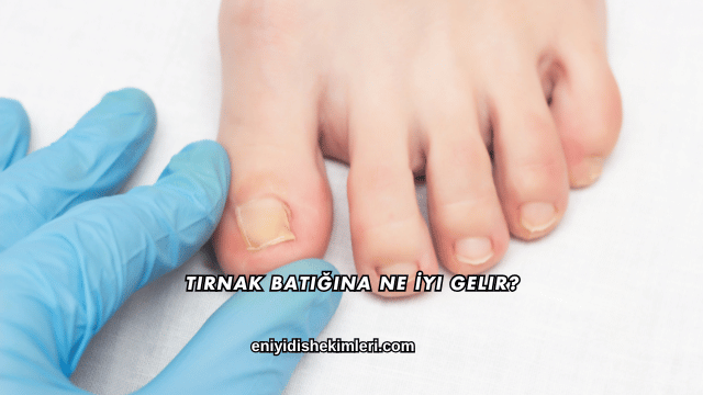 Tırnak Batığına Ne İyi Gelir?