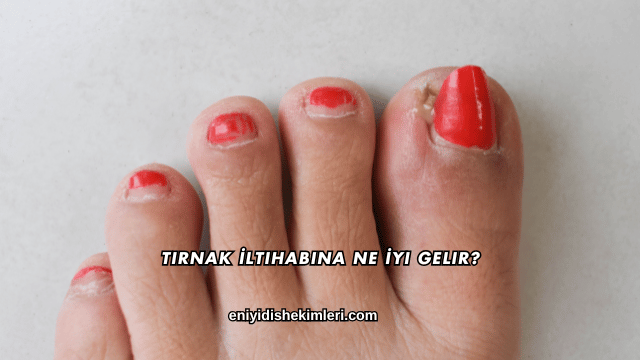 Tırnak İltihabına Ne İyi Gelir?