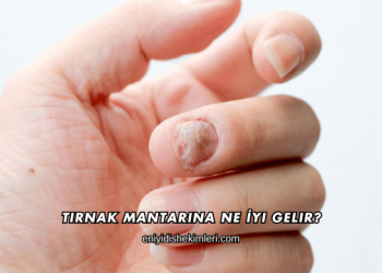 Tırnak Mantarına Ne İyi Gelir?