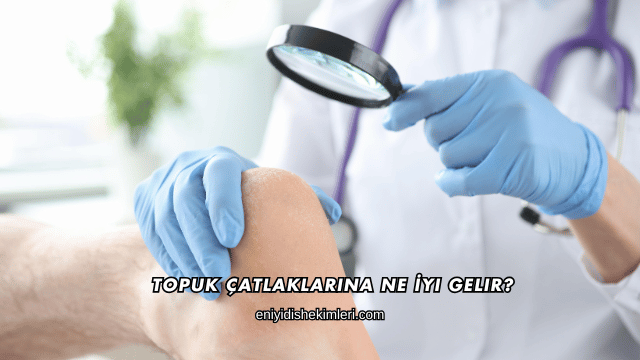 Topuk Çatlaklarına Ne İyi Gelir?