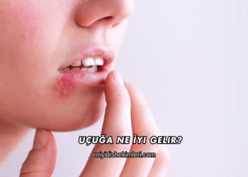 Uçuğa Ne İyi Gelir