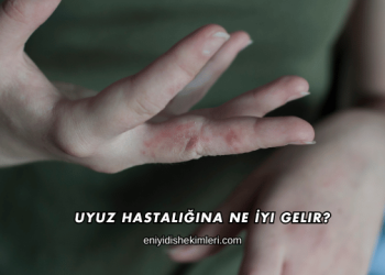 Uyuz Hastalığına Ne İyi Gelir?