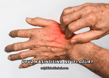 Uyuz Kaşıntısına Ne İyi Gelir?