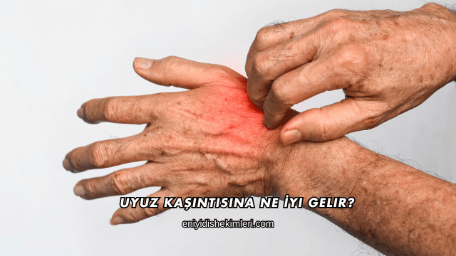 Uyuz Kaşıntısına Ne İyi Gelir?