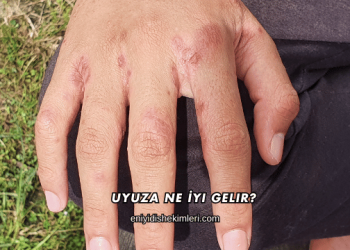 Uyuza Ne İyi Gelir?