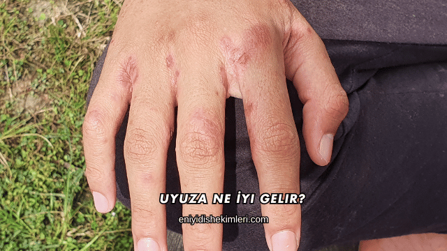 Uyuza Ne İyi Gelir?