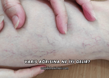Varis Ağrısına Ne İyi Gelir?