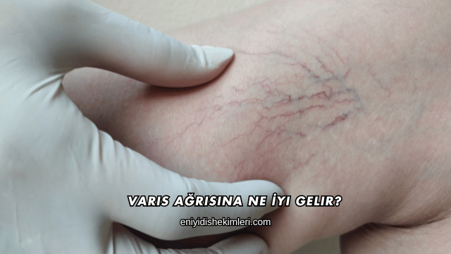 Varis Ağrısına Ne İyi Gelir?