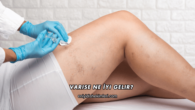 Varise Ne İyi Gelir?