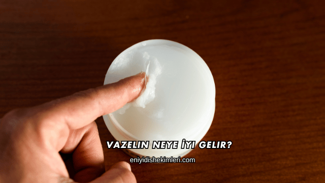 Vazelin Neye İyi Gelir?