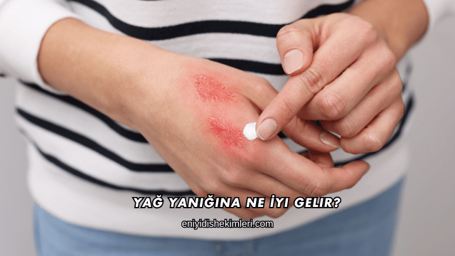 Yağ Yanığına Ne İyi Gelir?