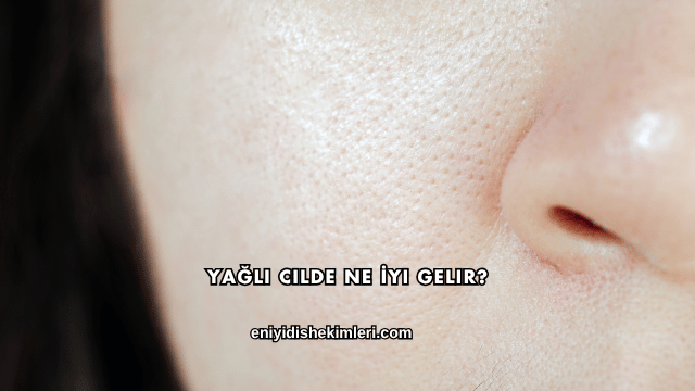 Yağlı Cilde Ne İyi Gelir?