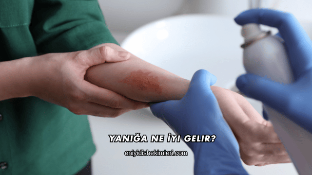 Yanığa Ne İyi Gelir?