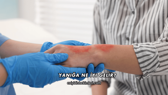 Yanığa Ne İyi Gelir?