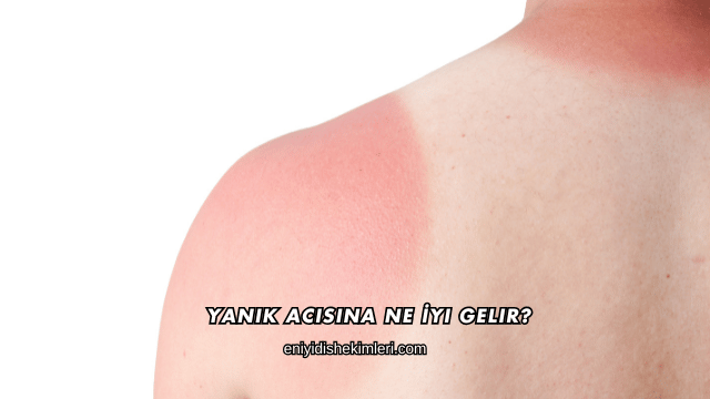 Yanık Acısına Ne İyi Gelir?