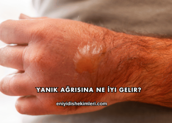 Yanık Ağrısına Ne İyi Gelir?