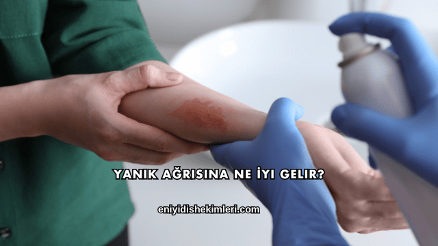 Yanık Ağrısına Ne İyi Gelir?
