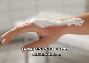 Yanık İzine Ne İyi Gelir?