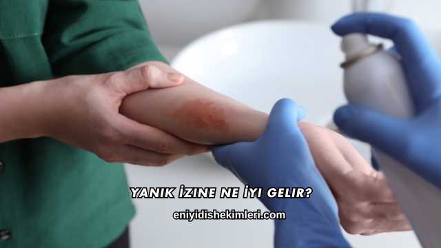Yanık İzine Ne İyi Gelir?