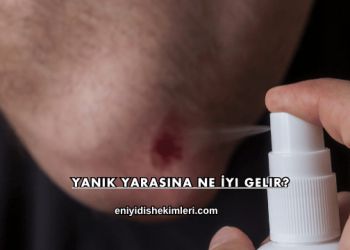 Yanık Yarasına Ne İyi Gelir?