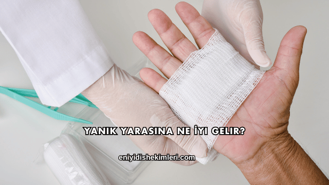 Yanık Yarasına Ne İyi Gelir?