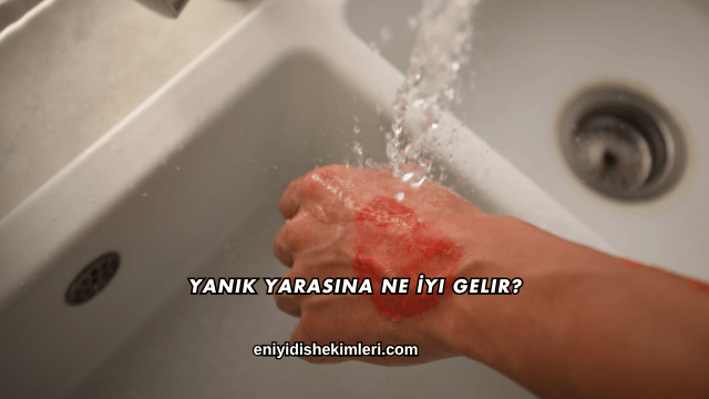 Yanık Yarasına Ne İyi Gelir?