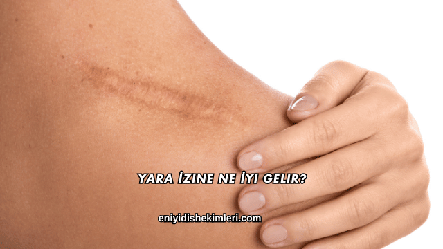 Yara İzine Ne İyi Gelir?
