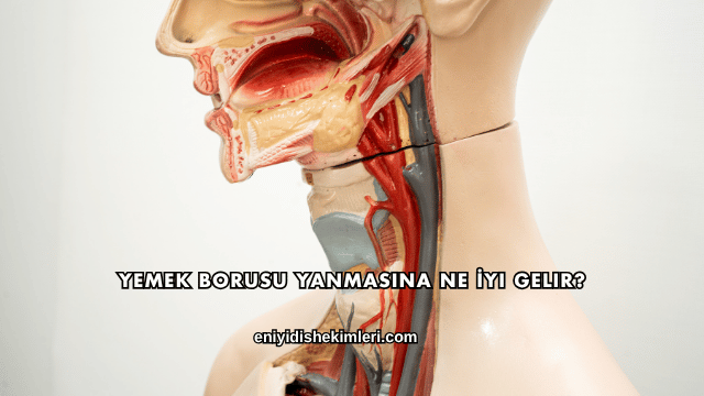 Yemek Borusu Yanmasına Ne İyi Gelir?