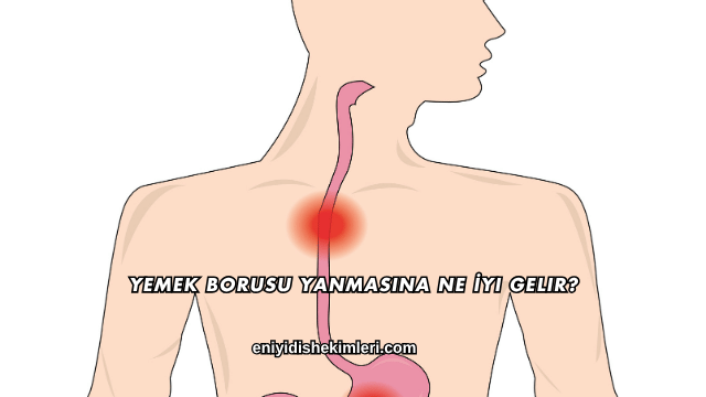 Yemek Borusu Yanmasına Ne İyi Gelir?