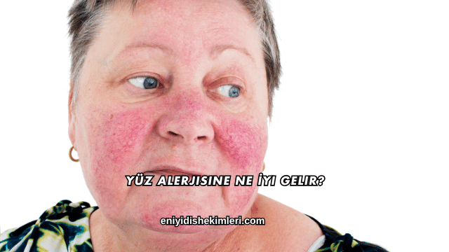 Yüz Alerjisine Ne İyi Gelir?