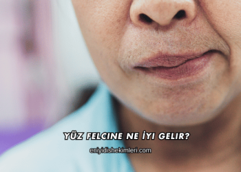Yüz Felcine Ne İyi Gelir?