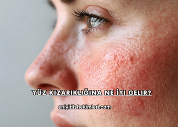 Yüz Kızarıklığına Ne İyi Gelir?