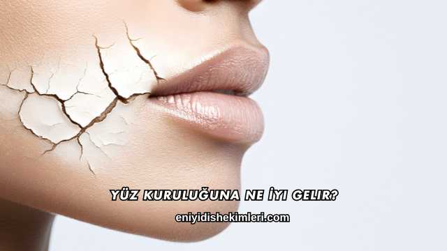 Yüz Kuruluğuna Ne İyi Gelir?