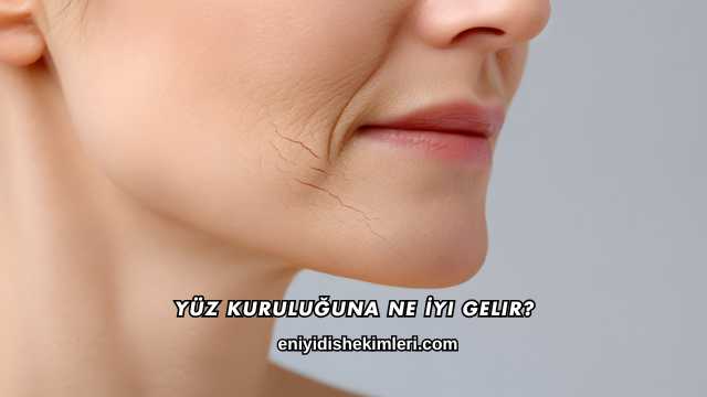 Yüz Kuruluğuna Ne İyi Gelir?