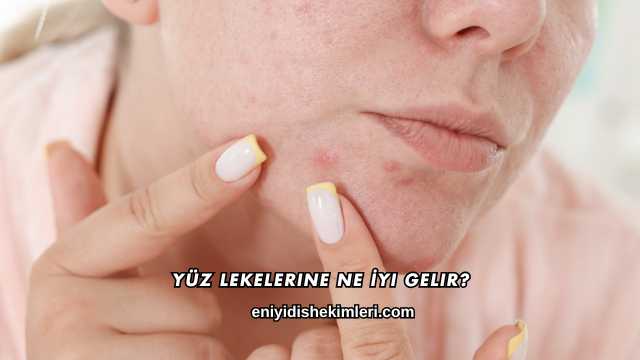 Yüz Lekelerine Ne İyi Gelir?