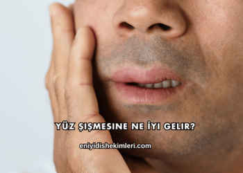 Yüz Şişmesine Ne İyi Gelir?