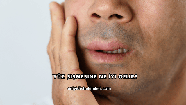 Yüz Şişmesine Ne İyi Gelir?