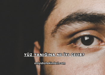 Yüz Yanığına Ne İyi Gelir?