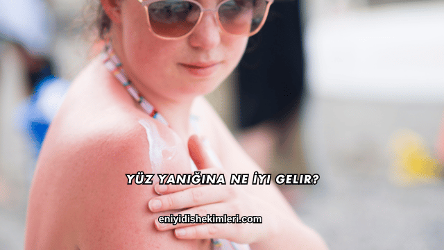 Yüz Yanığına Ne İyi Gelir?