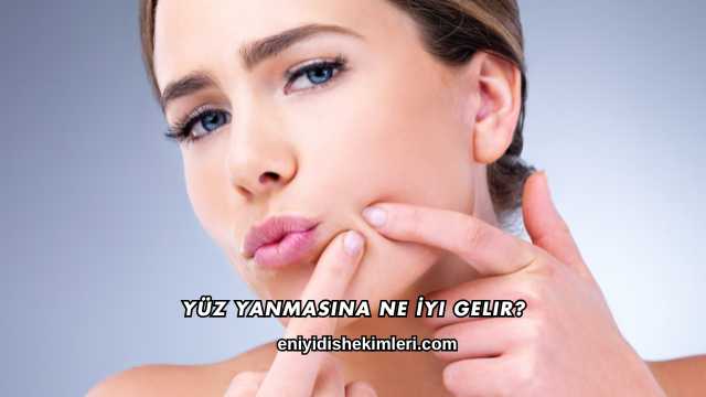 Yüz Yanmasına Ne İyi Gelir?