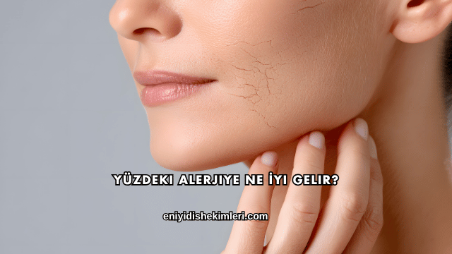 Yüzdeki Alerjiye Ne İyi Gelir?