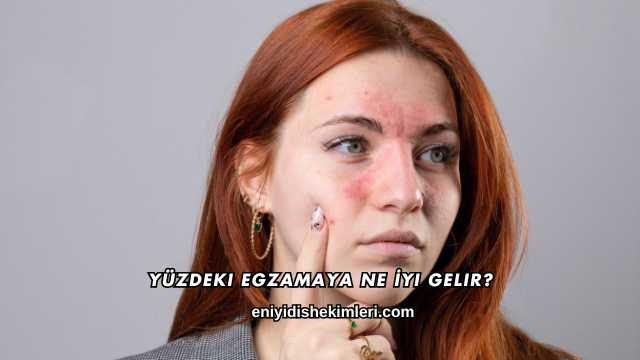 Yüzdeki Egzamaya Ne İyi Gelir?