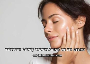 Yüzdeki Güneş Yanıklarına Ne İyi Gelir?