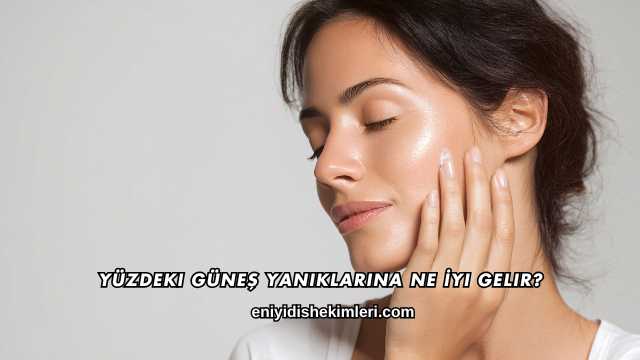 Yüzdeki Güneş Yanıklarına Ne İyi Gelir?