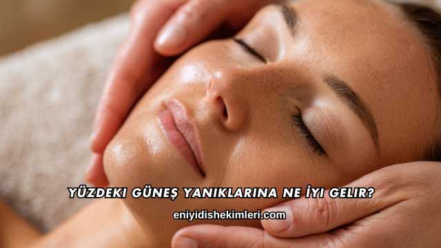 Yüzdeki Güneş Yanıklarına Ne İyi Gelir?