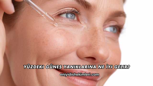 Yüzdeki Güneş Yanıklarına Ne İyi Gelir?