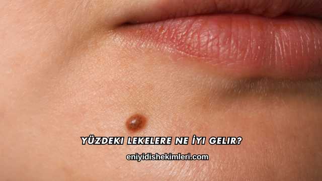 Yüzdeki Lekelere Ne İyi Gelir?